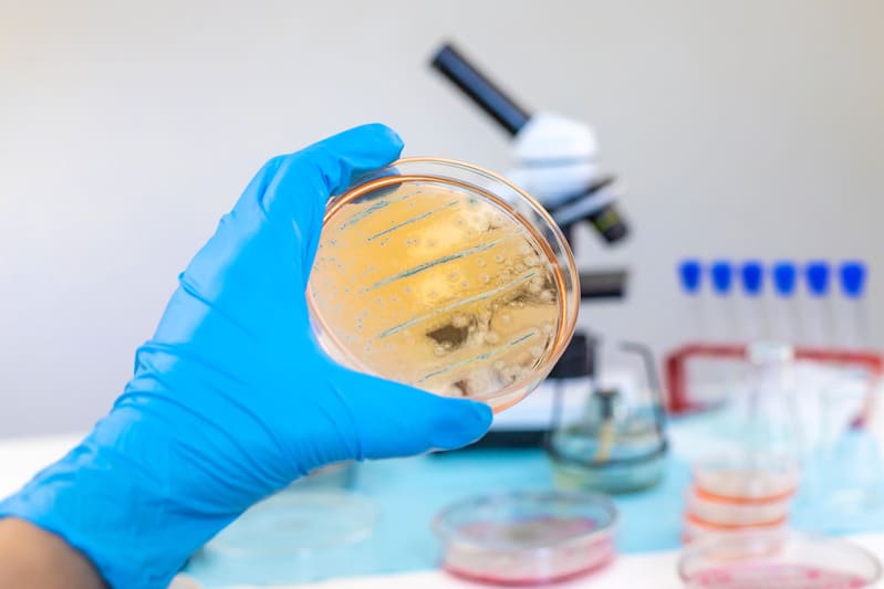 cultura bacterana din urina